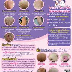 ผื่นแบบไหนควรรีบไปหาหมอ